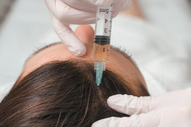 A woman getting a shot in the head at a cosmetology clinic. mesotherapy for hair growth