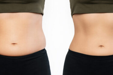 woman-s-belly-with-excess-fat-toned-slim-stomach-with-abs-before-after-losing-weight